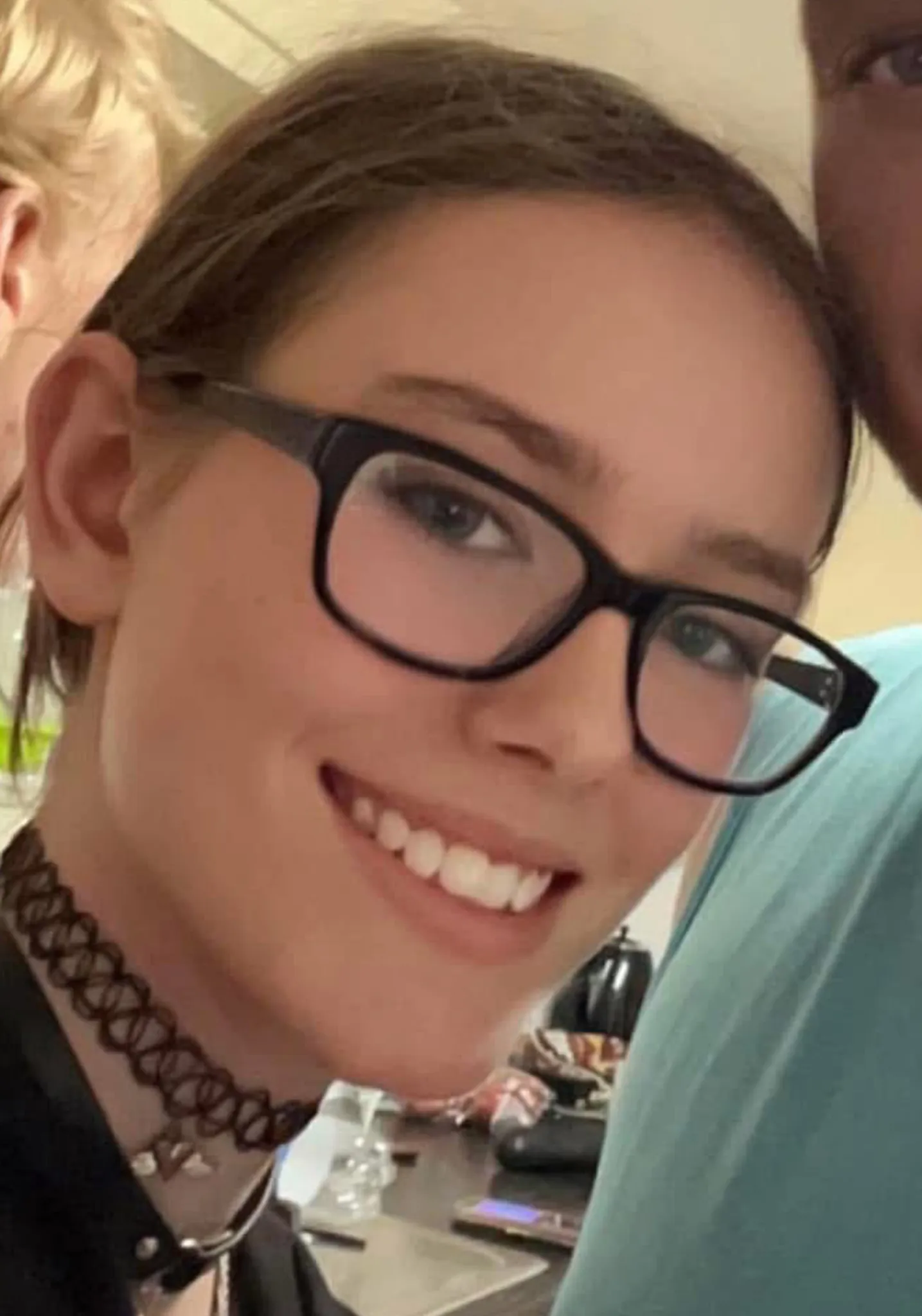 Image related to the news of the girl mauled by a dog.